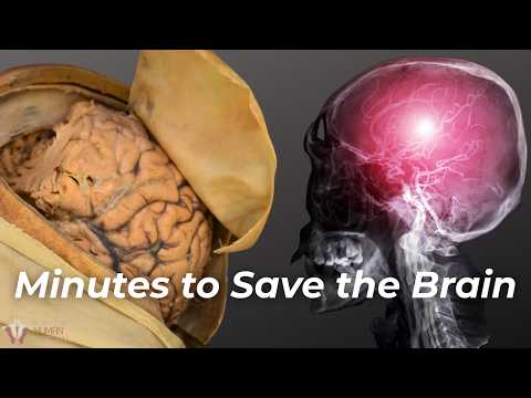 This Is What a Stroke Does to Your Brain (in Minutes)