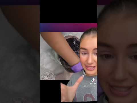 Commento la storia di questa ragazza albina