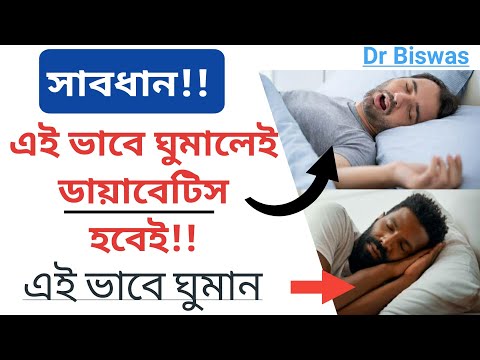 রাত করে ঘুমালেই Type 2 Diabetes হতে পারে - বাড়তে পারে blood sugar level । Dr Biswas Diabetes control