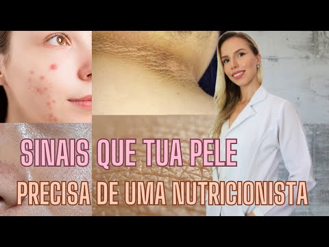 SINAIS QUE SUA PELE PRECISA DE UM NUTRICIONISTA -  Bruna Harmel