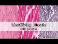 Differentiating Muscle Types