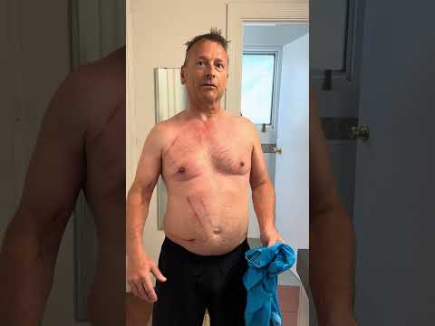Boxing Day Kangaroo Attack