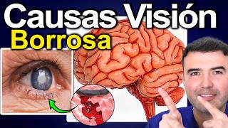 🎯 VISIÓN BORROSA EXPLICADA: como revertirla + 4 CAUSAS IMPORTANTES