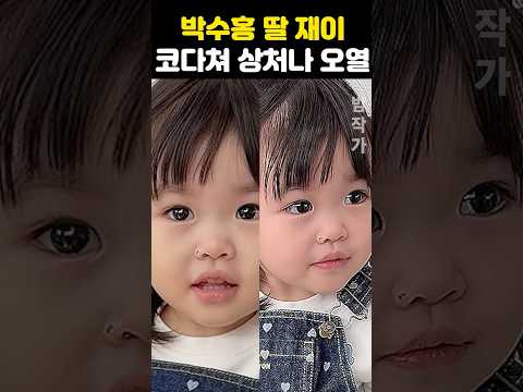박수홍 딸 <strong>재이</strong> 코다쳐 상처나 오열