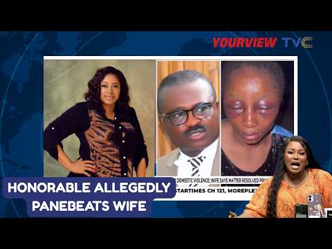 “A Leader Who Beats His Wife?” — Your View Ladies Slam Dickson Agbor’s Dishonorable Actions