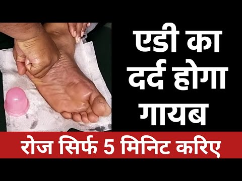 amazing massage technique for heel pain, plantar fasciitis, calcaneum spur - just do for 5 minutes