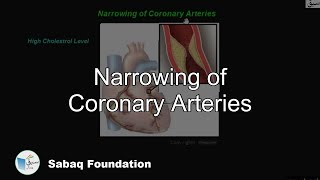 Narrowing of Coronary Arteries