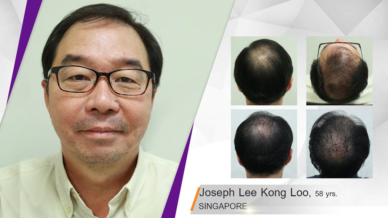 Joseph Lee Kong Loo FUT PRP