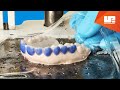 Dental Tray Preparation Techniques