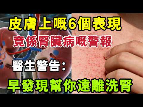【乐厨怡妈】6個隱藏係皮膚上嘅腎臟病警訊，越早知道，越快逆轉腎功能，遠離洗腎。