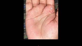 Shadi kab hogi ? Gov job kab lagegi !! Real palm analysis