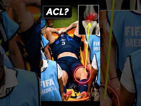 Doctor Explains Ugarte’s Knee Injury: One of Sports’ Most Dangerous Positions #WorldCup2026