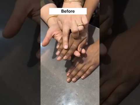 Easy Fair Hand Tips | Hand Darkness Removal Recipe | Easy Manicure | Remove Suntan #recipe #shorts
