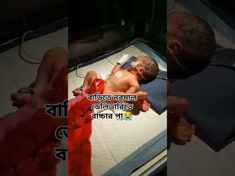 বাবুর জন্য দোয়া করবেন 🙏❤️ #baby #motivation #cutebaby #love #sad #twins #cute #ytshorts #nicumom
