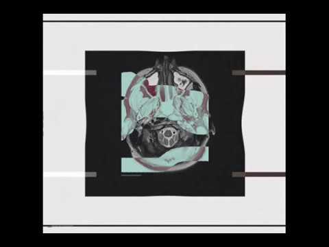Suciu - Translucid