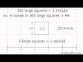 ECG Interpretation and Heart Rate Calculation