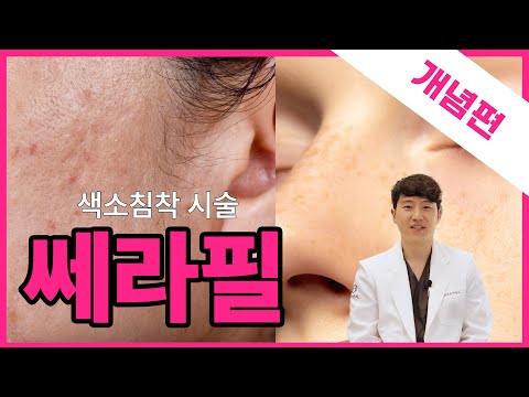 저자극 색소침착 치료, 쎄라필 / 시술위키 쎄라필 개념편