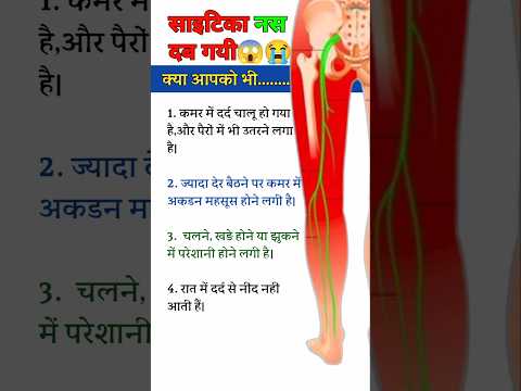 Sciatica Ka Dard 😭😱🔥 #viralvideo #viralshorts #physiodrdeepaksoni #sciatica