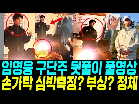 임영웅 구단주 뒷풀이 영상 통대관 깜놀 / 손갈가 심박측정기? 부상 ?반지? 정체 알고보니