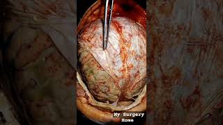 this is human brain #human #humanbody #foryou #vairalvideo #postmormon #bodyexercises #type