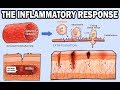 Inflammatory Response Mechanisms