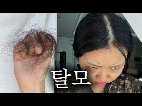 기어코 22살에 탈모가 와버린 간호학과 브이로그