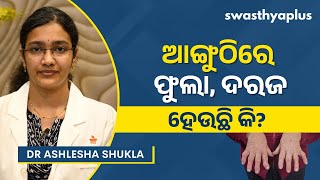 ରୁମାଟଏଡ୍‌ ଆର୍ଥ୍ରାଇଟିସ୍‌: କ’ଣ ରହିଛି ଚିକିତ୍ସା? | Rheumatoid Arthritis in Odia | Dr Ashlesha Shukla
