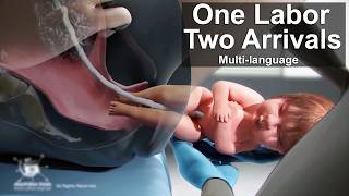 One Labor, Two Arrivals . Multi-language Available