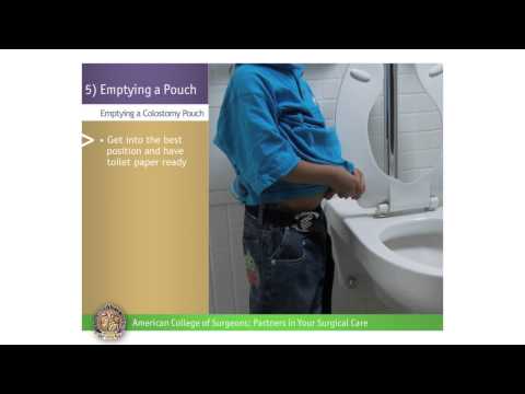 Pediatric Colostomy/Ileostomy: Emptying a Pouch