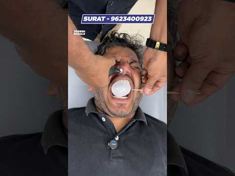 CFR for Facial Pain #chiropractor #asmr #migraine #virals