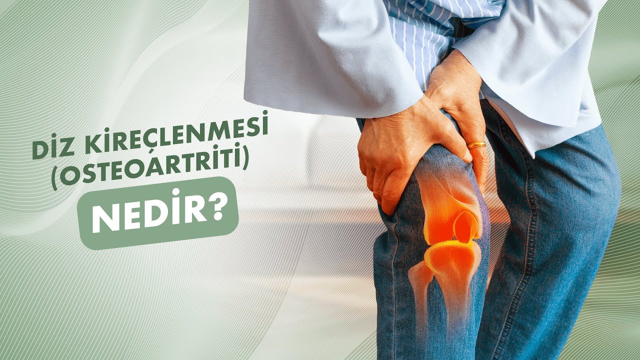 Diz Kireçlenmesi Neden Olur? Kireçlenmenin Sebepleri ve Tedavisi