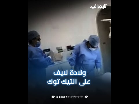 "تكبيس يا شباب".. عملية ولادة لايف على "تيك توك" ومصير مجهول للطبيبة