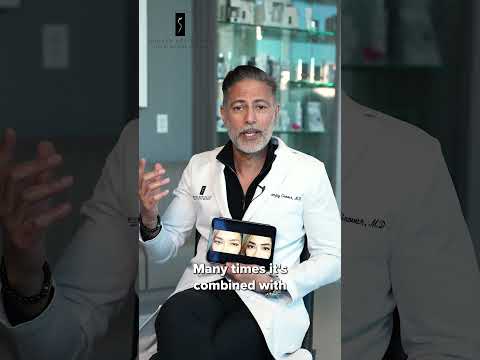 Dr. Grover Discusses Brow Lift