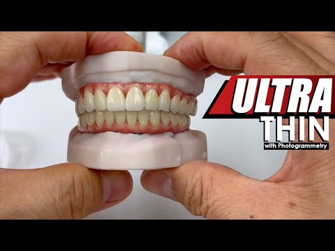 Ultra-Thin, Full-Mouth Restoration Using Photogrammetry