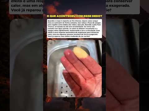 O frio pode literalmente desligar a circulação. #mistérios #curiosidades