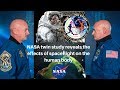 Effects of Spaceflight on Human Health