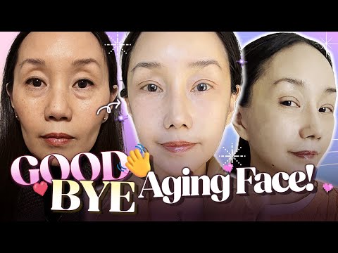 How I look 20 years younger in a month...💖  | Shell's plastic surgery journey at Braun! (Part 1)