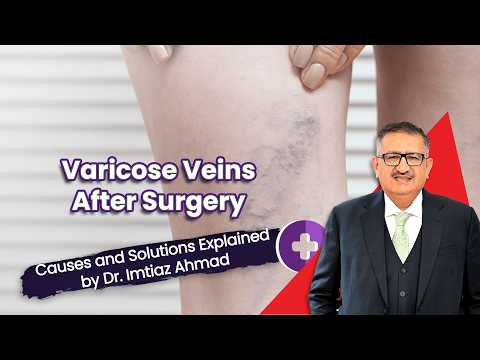 Varicose Veins After Surgery: Causes and Solutions Explained by Dr. Imtiaz Ahmad