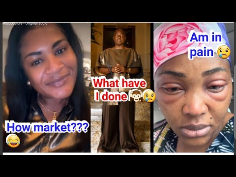 "The universe might be telling you to return someone's husband"_Netizans reacts to Mercy eye infectn