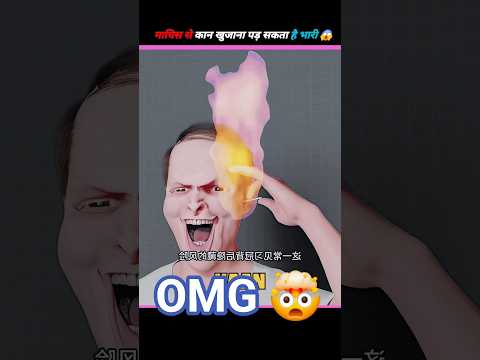 माचिस से कान खुजाना पड़ सकता है भारी 😱 | Ear Fact | Dangerous Experiment | #shorts