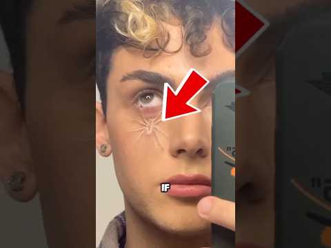 إذا رأيت عنكبوتًا تحت جلد شخص ما ، فلا داعي للذعر!  😱 #shortsviral #shortvideo #shorts