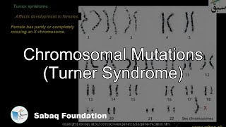 Chromosomal Mutations (Turner Syndrome)