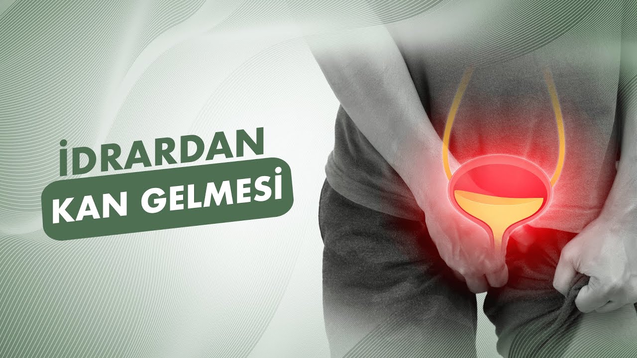 İdrardan Kan Gelmesi Ne Anlama Gelir?