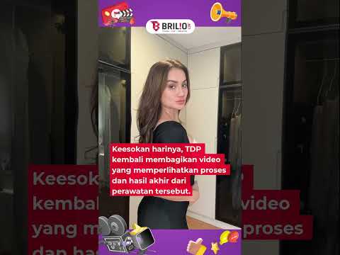 Fokus percantik diri usai cerai, Tengku Dewi Putri pamerkan hasil operasi dada dan perut