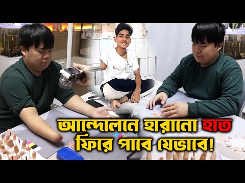 আন্দোলনে হাত হারানোদের মুখে হাসি ফুটাতে পারে এই প্রযুক্তি।