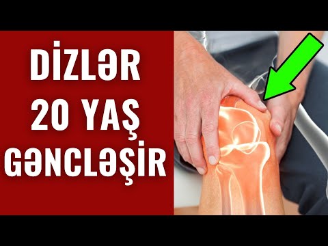 Dizlər AĞIRMASIN | Sağlam Diz Oynaqları üçün Möcüzəvi Müalicə