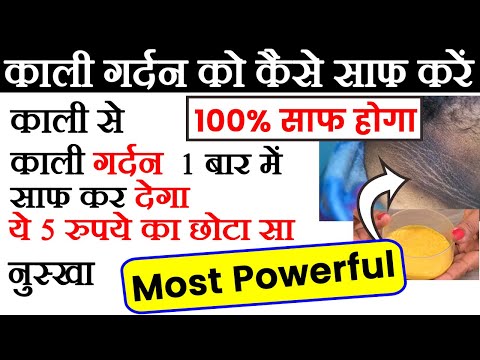 काली गर्दन को कैसे साफ करें: ये 1 बार लगाने से ही काली गर्दन एकदम साफ हो जायेगी, How To Clean Neck