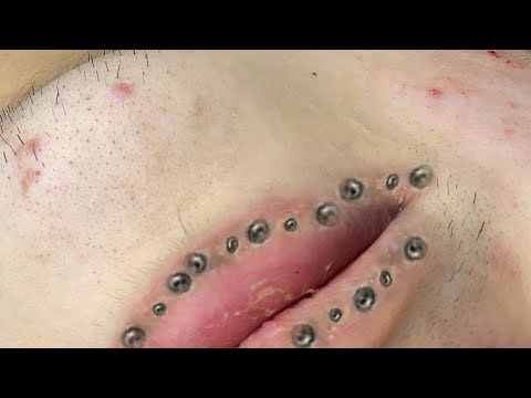 كيفية الحفاظ على نظافة الوجه يومياBT6789