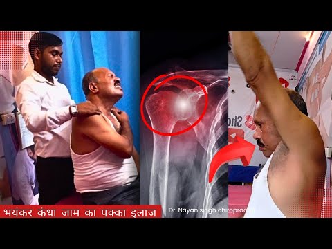 frozen shoulder chiropractic treatment india, dr nayan singh, best chiropractor india, kandha jaam