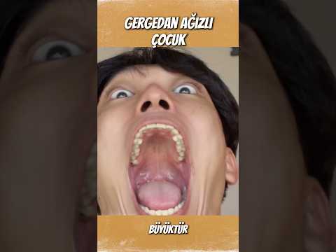 HER ŞEYE TEK ATAN ÇOCUK #ilginç #merak #tuhaf